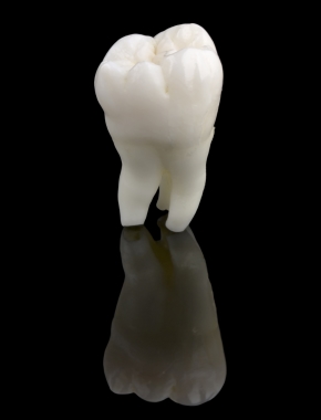 Wisdom teeth